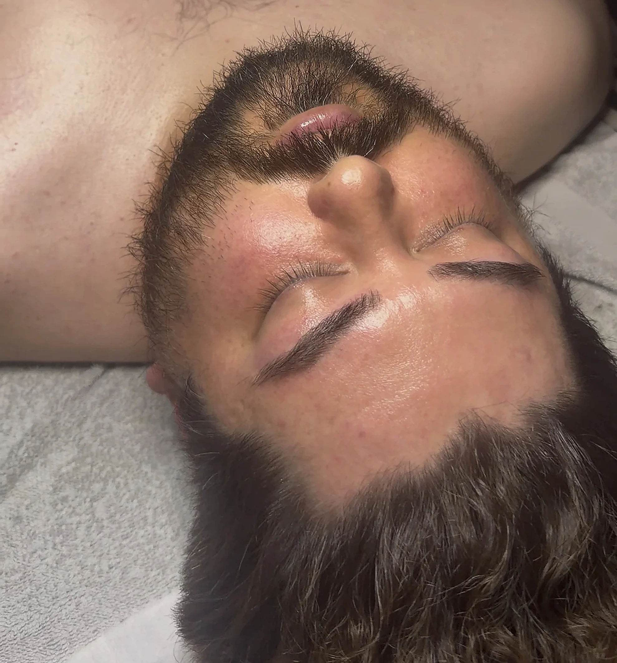 Close-up of a client's skin after a skincare session